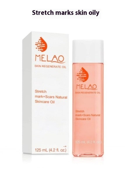 125ml Stretch Marks Skin Care Moisturizing Hydrating